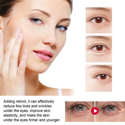 Anti aging eye cream