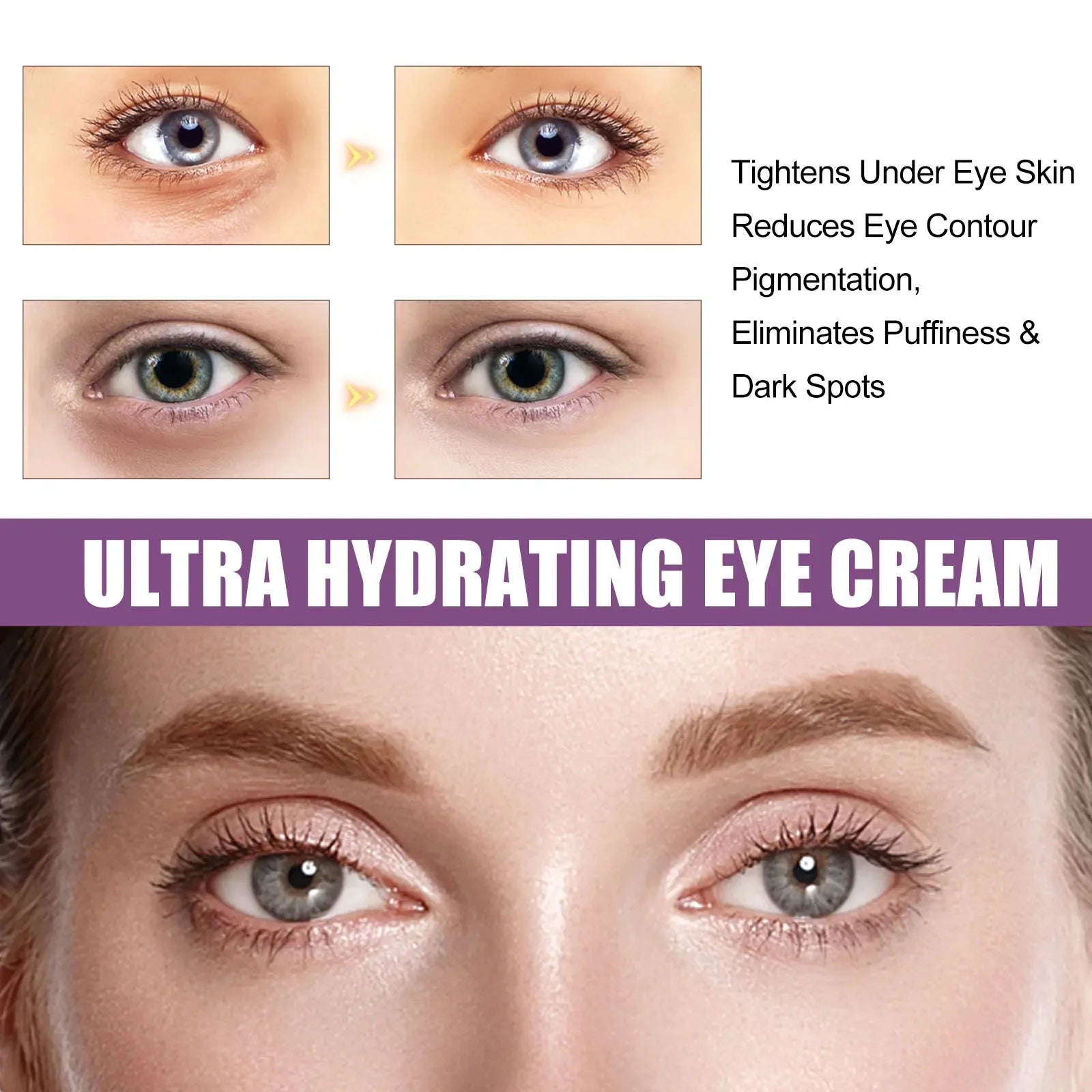Dark circles eye cream