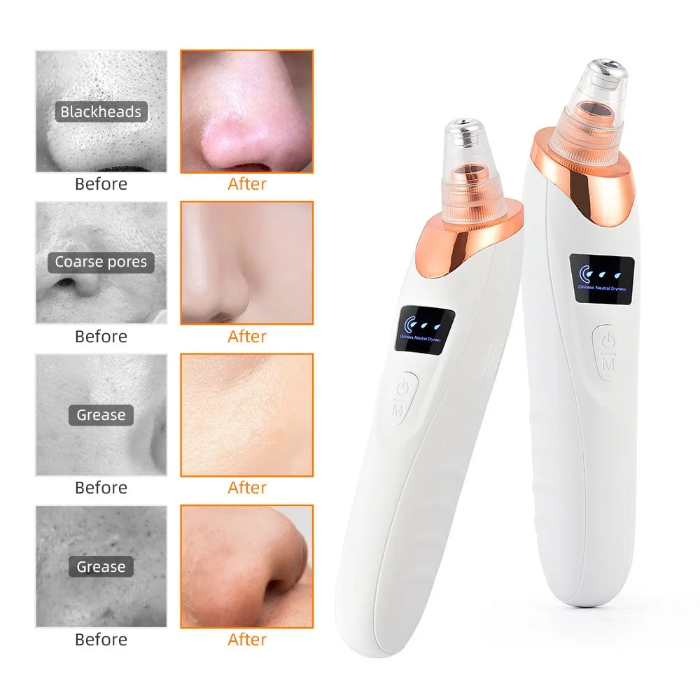 Durable skin care facial machine