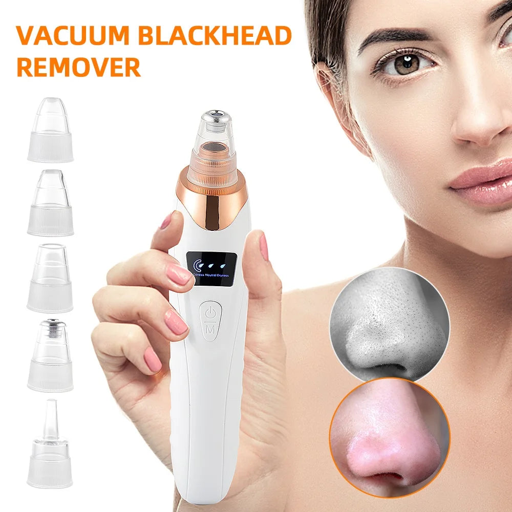 Professional blackhead remover
