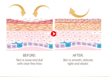 Best eye cream for dark circles and puffiness